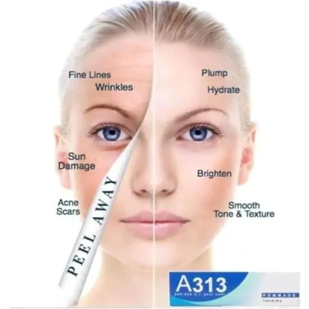 A313 Retinol Cream 50g - Image 3