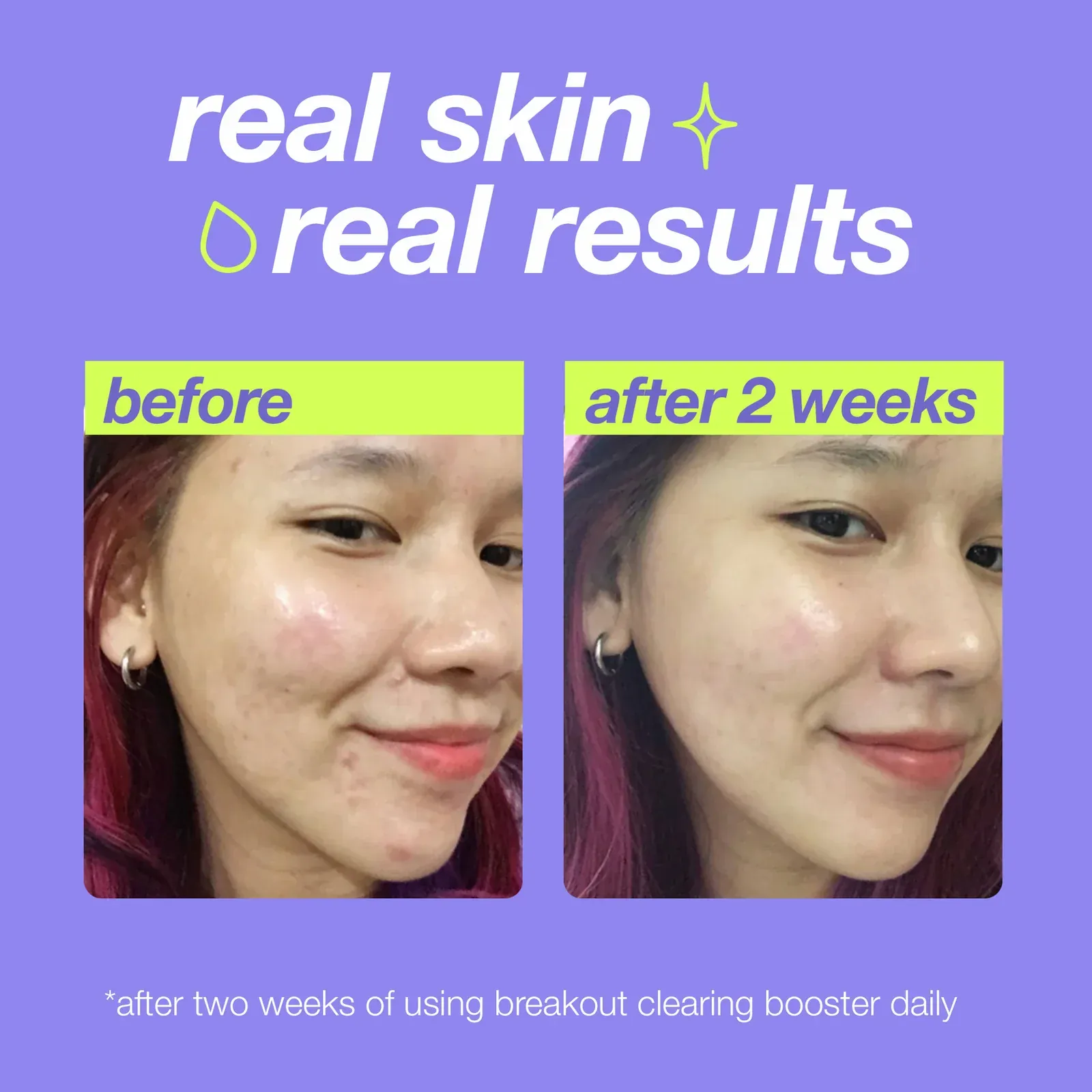 Dermalogica Clearstart Breakout Clearing Booster 30ml - Image 6