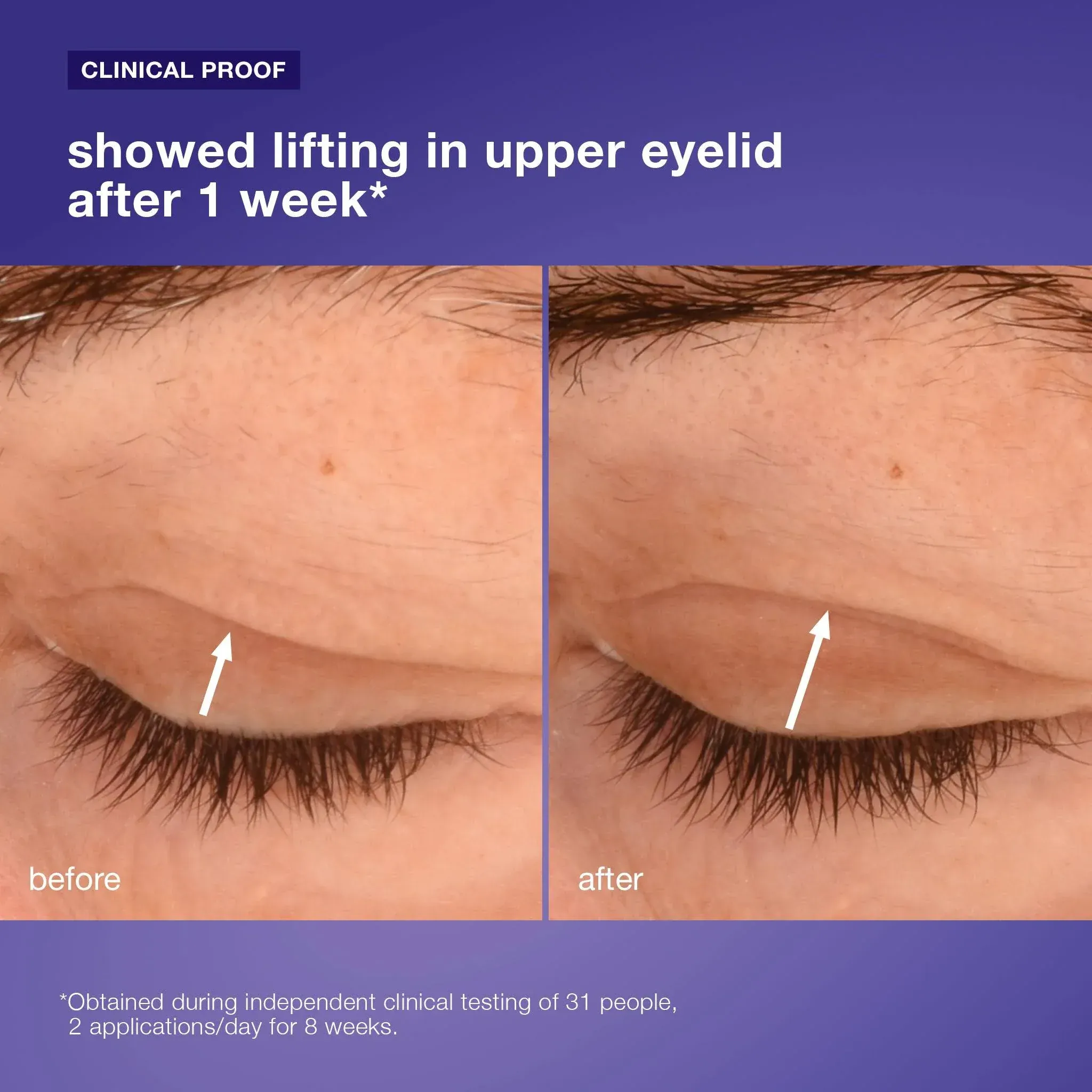Dermalogica Phyto Nature Lift Eye Cream 15ml - Image 5