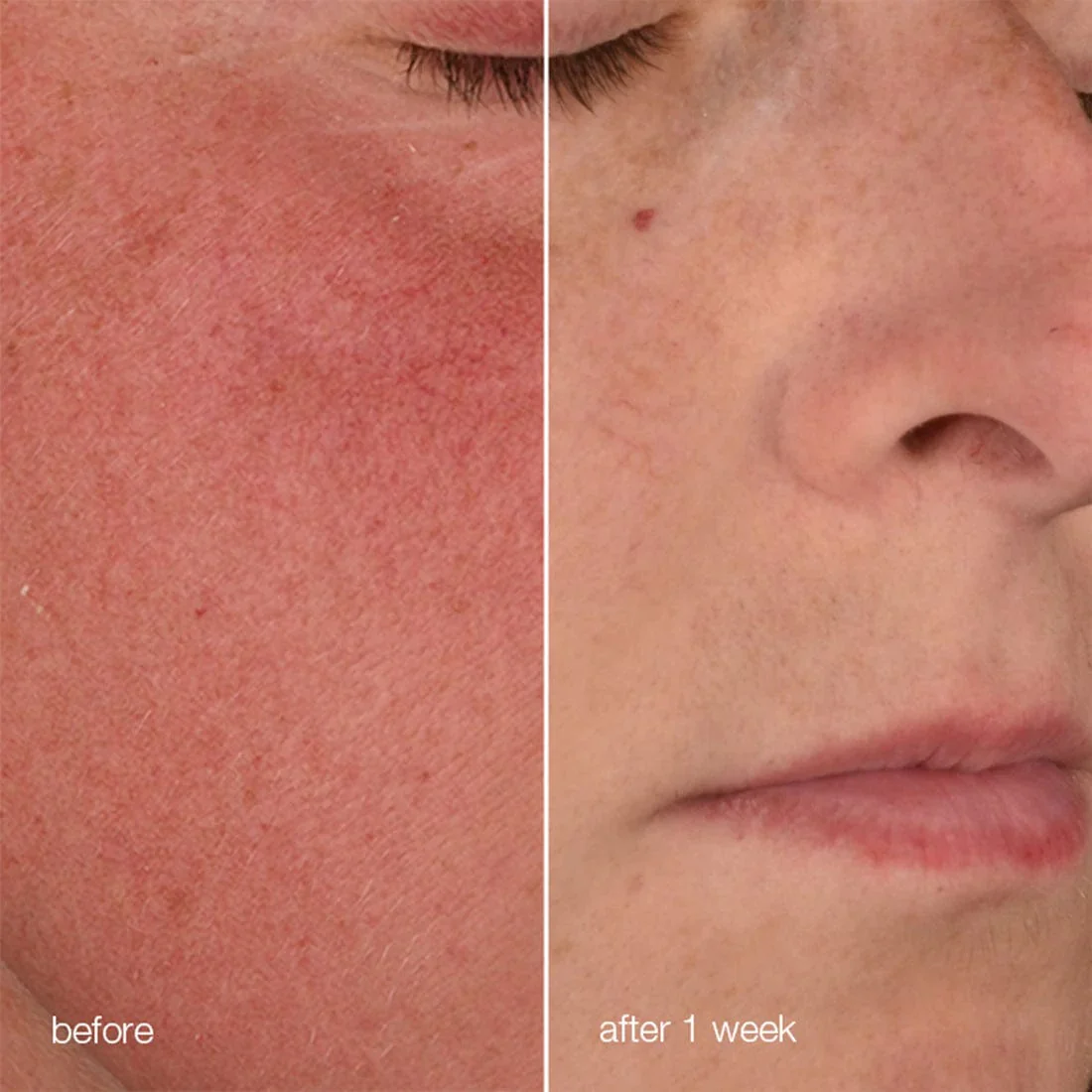Dermalogica Stabilizing Repair Cream 50ml - Image 3