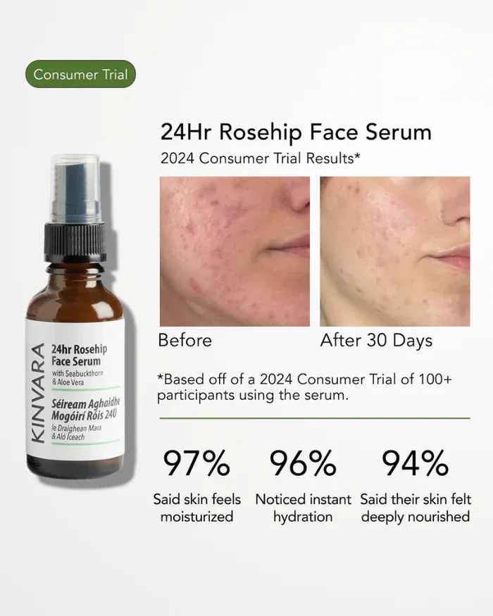 Kinvara Natural Skincare 24hr Rosehip Face Serum 30ml - Image 6