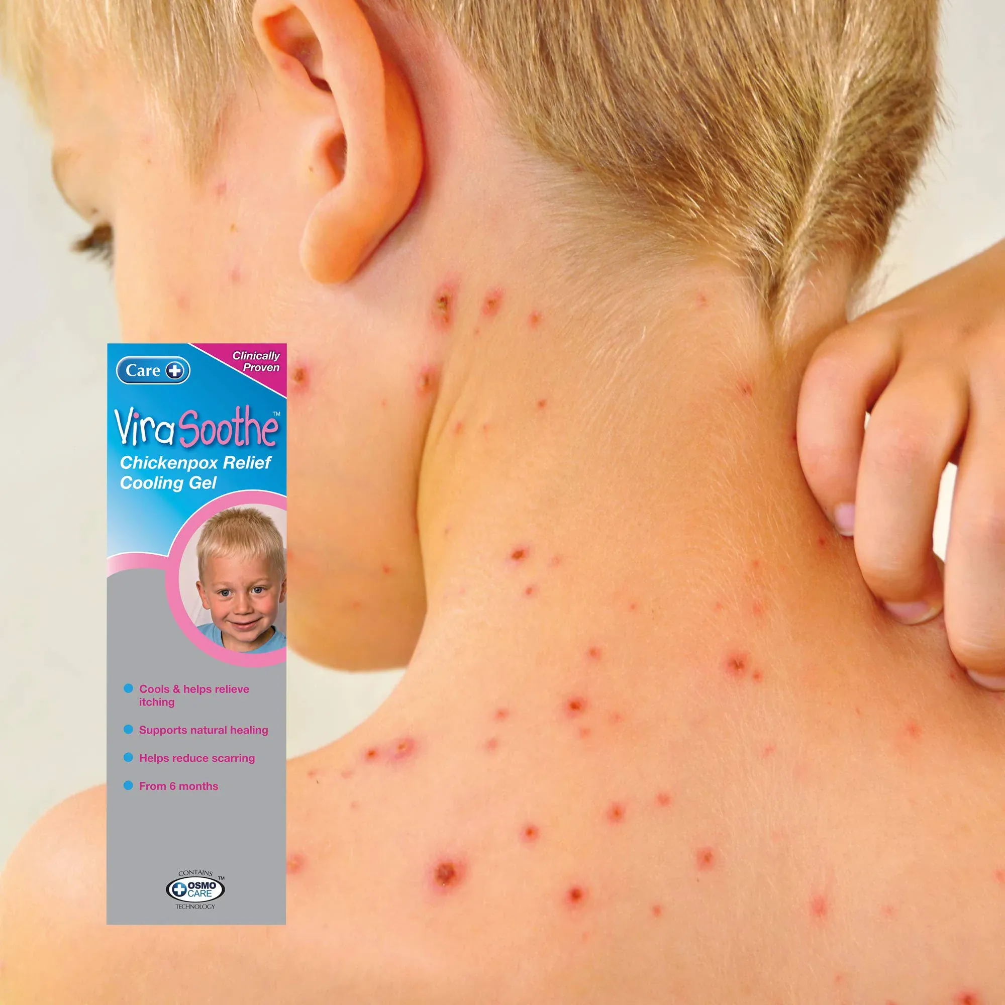 Virasoothe Chickenpox Relief Cooling Gel 75g - Image 5
